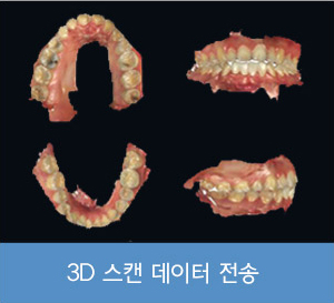 통증 걱정 하지 않으셔도 됩니다.(무통마취)