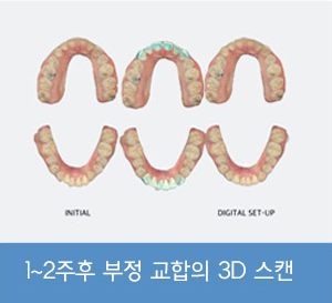 통증 걱정 하지 않으셔도 됩니다.(무통마취)