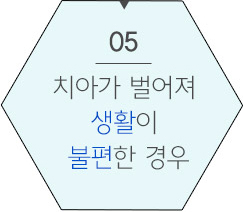 돌출입이면서 사각턱이신분