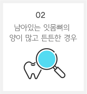 자가 치아 뼈이식재