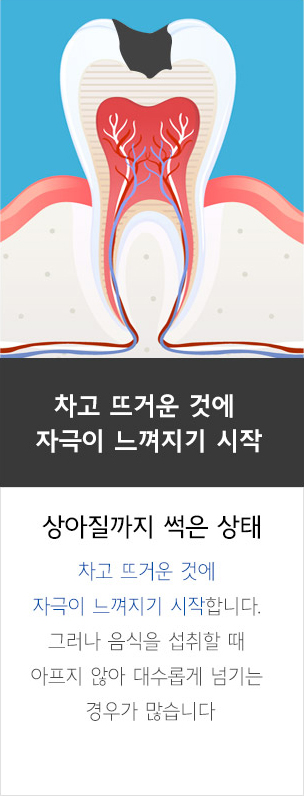 자가 치아 뼈이식재